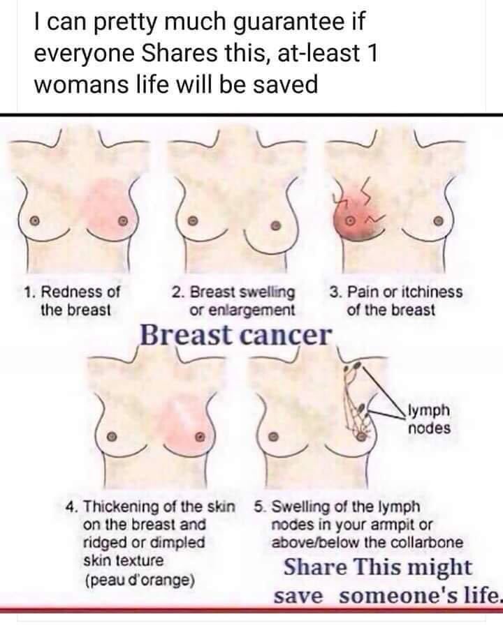 csmcgo's tweet photo. Examine ur #breasts min 1 x mth (@ same time of mth as they change with cycle) & check up into armpits. If u don’t know how/aren’t sure ask ur #GP to show U. See #GP if U have nipple discharge or changes, dry/puckered or orange peel skin changes or lumps. #GPAdvice #breastcancer https://t.co/gUdToKAjTY