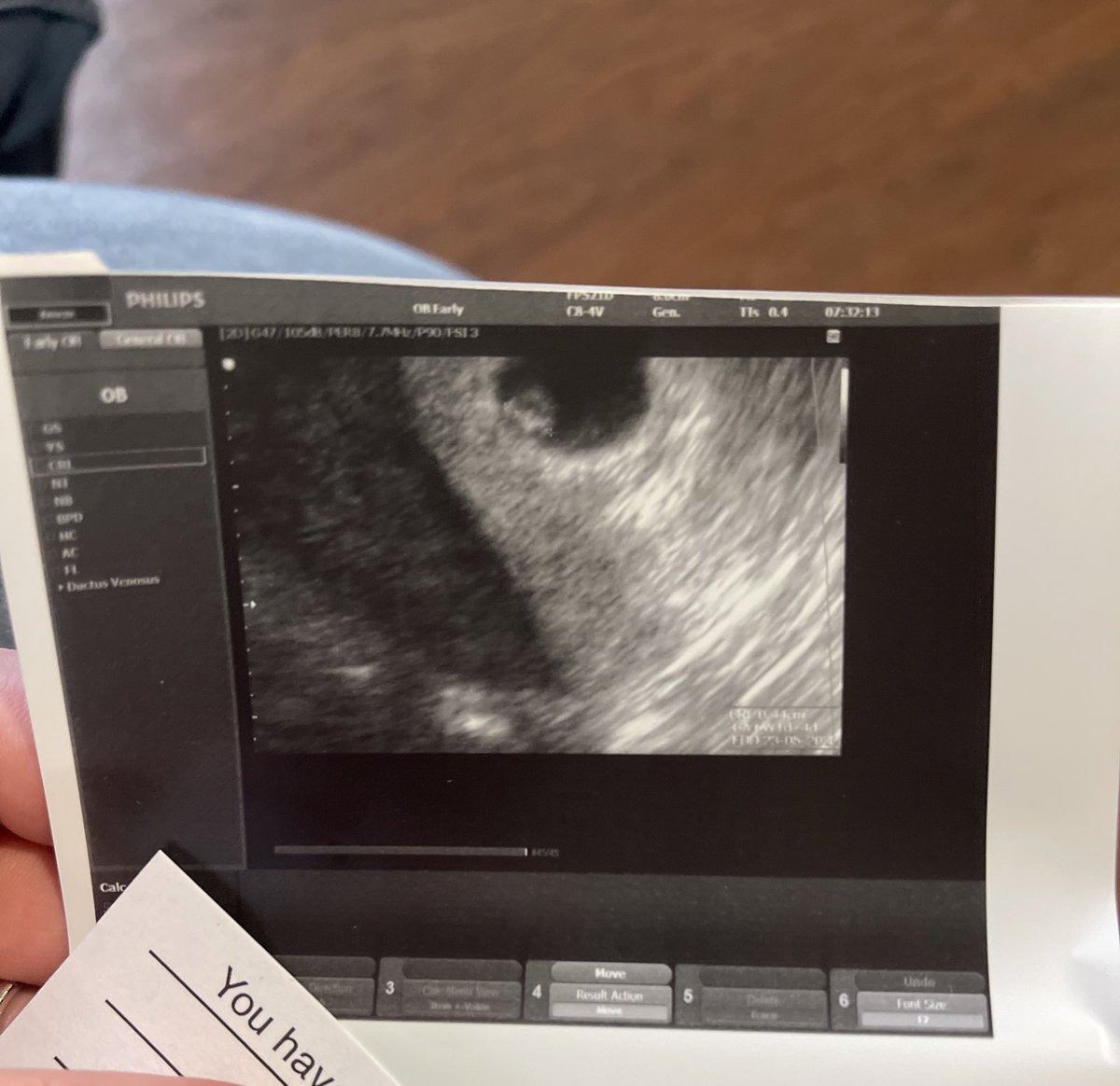 _princesslyssa's tweet photo. @skyla_danielle_ My little baby 🥺🤍 like for real dude how is this real https://t.co/4qqz5tVBNh