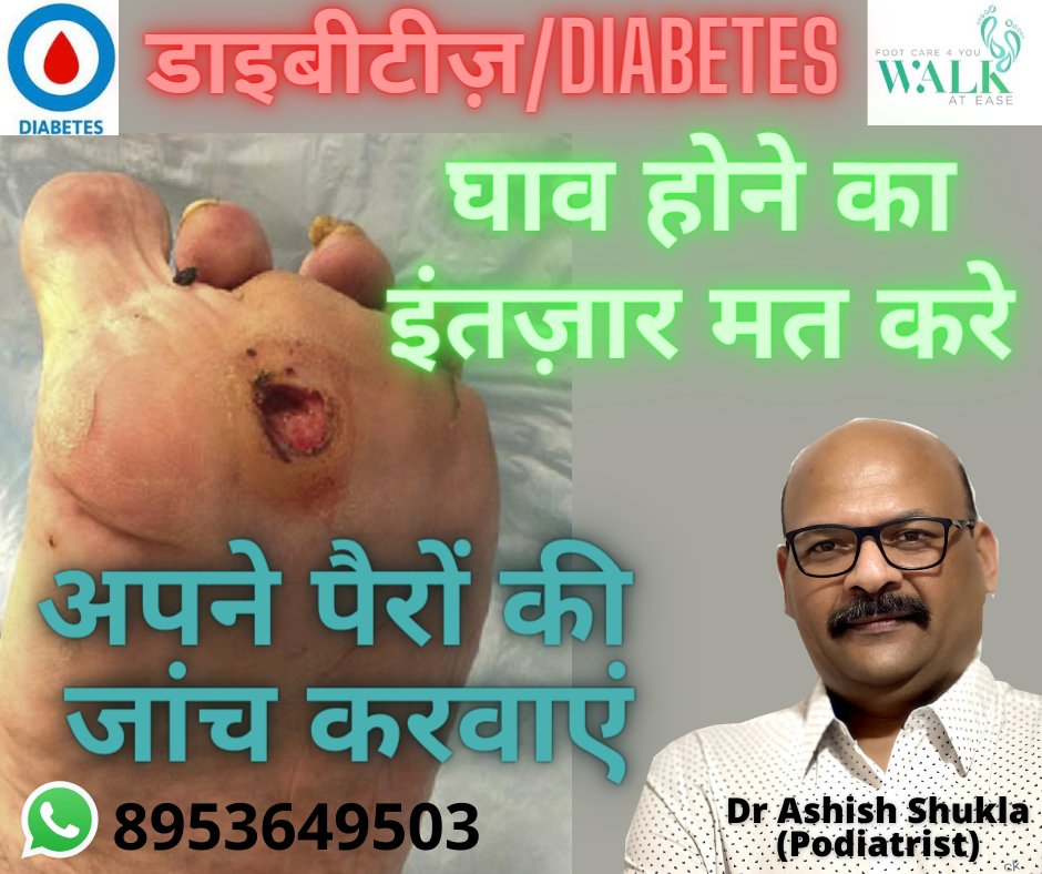podashish's tweet photo. #savefeet #walkatease #footcare4u #diabetesfeet  #preventamputation #talkaboutfeet #feetIndia #footswelling
#diabetes #diabeticfoot #diabeticulcer #diabeticfootulcer #peripheralneuropathy #podiatristindia #podiatristlucknow #savefeetindia #savefeetdiabetes #footdrindia #footpain https://t.co/eTGGYyv1IY