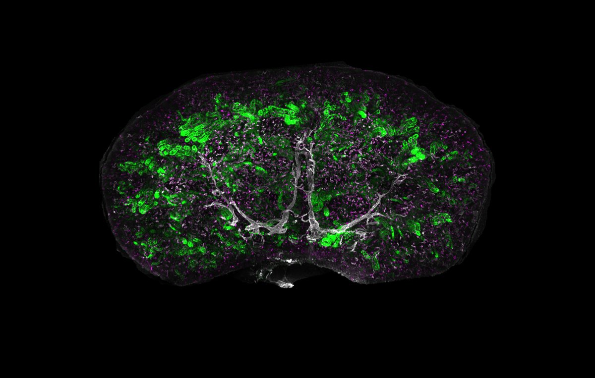 And our photo competition winner is...
Dr Laura Wilson's stunning image of macrophages (purple), kidney tubules (green) and lymphatic vessels (white) in a developing kidney🏆 
📸‘More than just tubules – the importance of the immune system in growing a kidney’. 
#KidneySnapshots