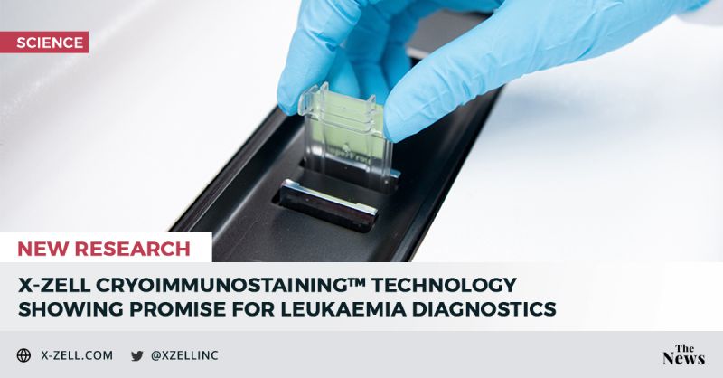 X-ZELL (@xzellinc) on Twitter photo RESEARCH UPDATE – According to new research presented at Adelaide's Blood 2021 Conference, <a href="/XZELLInc/">X-ZELL</a>’s Cryoimmunostaining technology could significantly improve #leukaemia #diagnostics in settings with limited access to flow cytometry. Full publication: lnkd.in/d6jxHmGf RESEARCH UPDATE – According to new research presented at Adelaide's Blood 2021 Conference, <a href="/XZELLInc/">X-ZELL</a>’s Cryoimmunostaining technology could significantly improve #leukaemia #diagnostics in settings with limited access to flow cytometry. Full publication: lnkd.in/d6jxHmGf