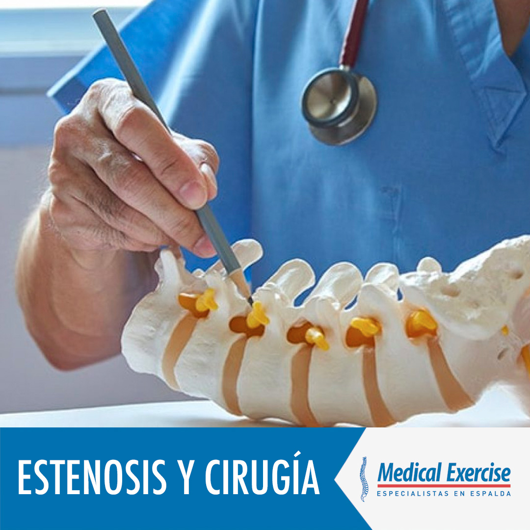 Medical_EX's tweet photo. ⚠️ La cirugía no es la única opción, ni la más adecuada en muchos casos de estenosis. En aquellos en que es necesaria debe ir precedida y/o seguida de tratamientos fisioterapéuticos y Potenciación Muscular Selectiva (PMS®) para obtener resultados óptimos a largo plazo. https://t.co/eTFduIFkyy