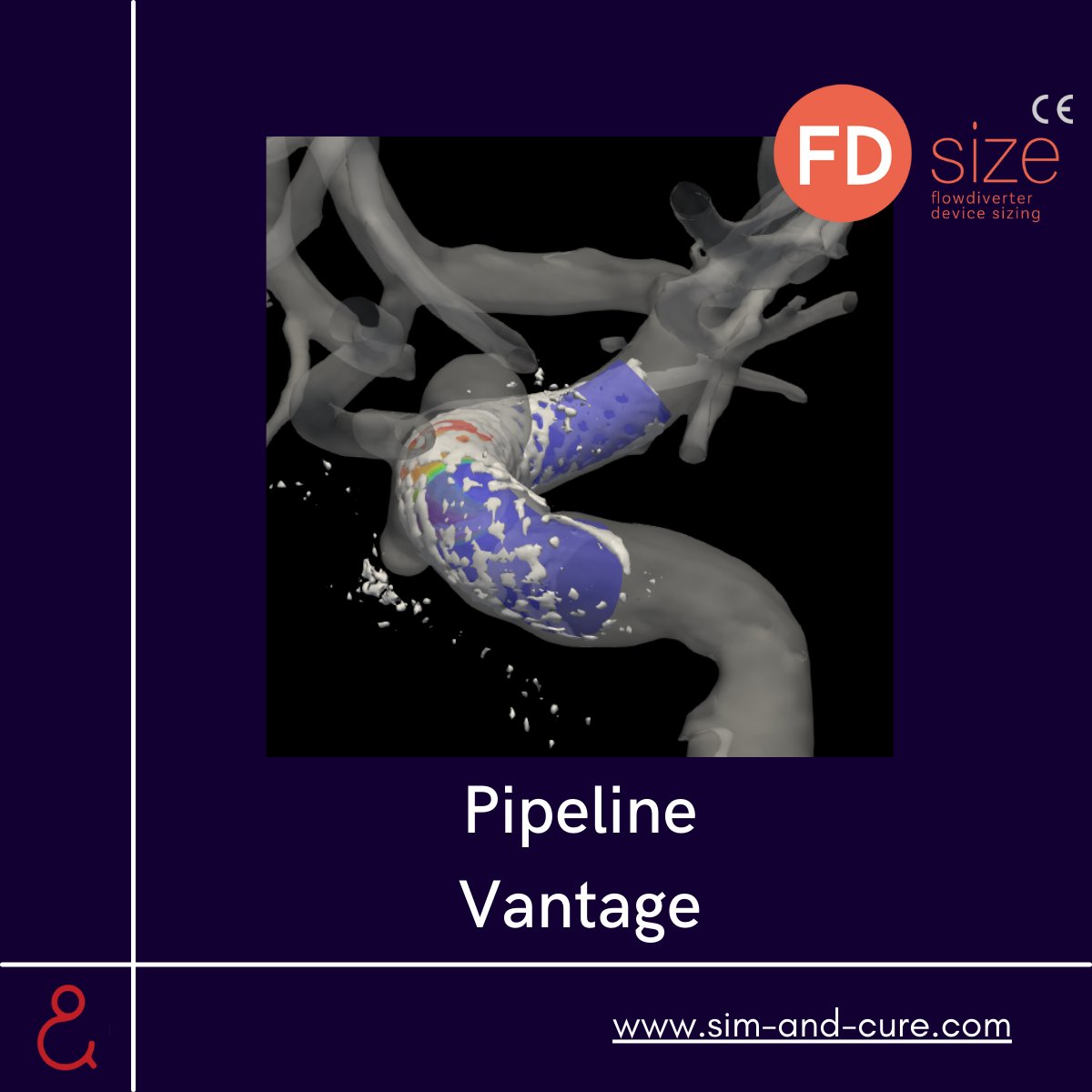 Nice case on two Paraophthalmic #aneurysm .Both covered with a single Pipeline Vantage™ simulated on Sim&amp;Size™ . Performed by Dr Harri Littow and Dr. Juha-Matti Isokangas. Congratulations for such an effective treatment and thank you for you #trust
<a href="/Medtronic/">Medtronic</a> <a href="/Medtronic_NV/">Medtronic Neurovascular</a>