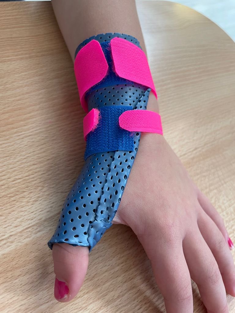 ESNEFT_MSK's tweet photo. Our hand therapists are making amazing splints #AHPsDay #ESNEFT #adayinthelifeofMSK https://t.co/qx18BWlCTG