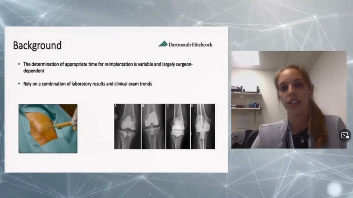 At the OREF Northeast Resident Symposium co-hosted by <a href="/DHOrtho/">Dartmouth Ortho</a>, Tracy Borsinger, MD, discusses whether time to reimplantation after explant for PJI influences the likelihood of a successful outcome at 2 years. Watch live: bit.ly/3axzys4 <a href="/DartmouthHitch/">Dartmouth Health | Inactive</a> #Orthosymposia