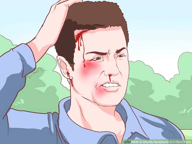 afrkml's tweet photo. Ingat ya! SEMUA cedera kepala HARUS dianggap serius. Meski gk ada perdarahan, ttp hrs observasi ketat 24 jam pascacedera. Ada suatu periode sadar sementara yg disebut Lucid Interval, padahal aslinya internal bleeding. Ini yg menipu &amp; jd bnyk kasus meninggal pasien2 cedera kepala. https://t.co/lBOR5ox8Ne