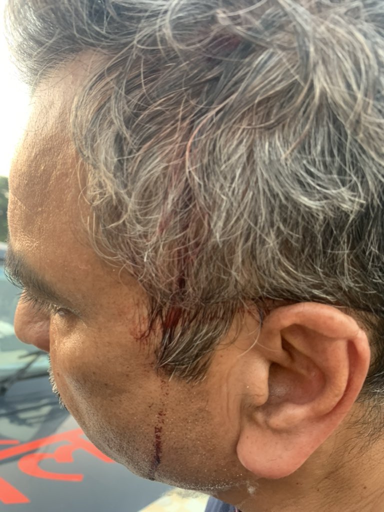 drsandeepsinha's tweet photo. @SwiggyCares Swiggy cares? Delivery boys employs criminal tendencies. *Hits with helmet a 59 yrs old Dr Deb at Rangoli Green gate Jaipur. Great Swiggy. https://t.co/fzQaJJTvtQ