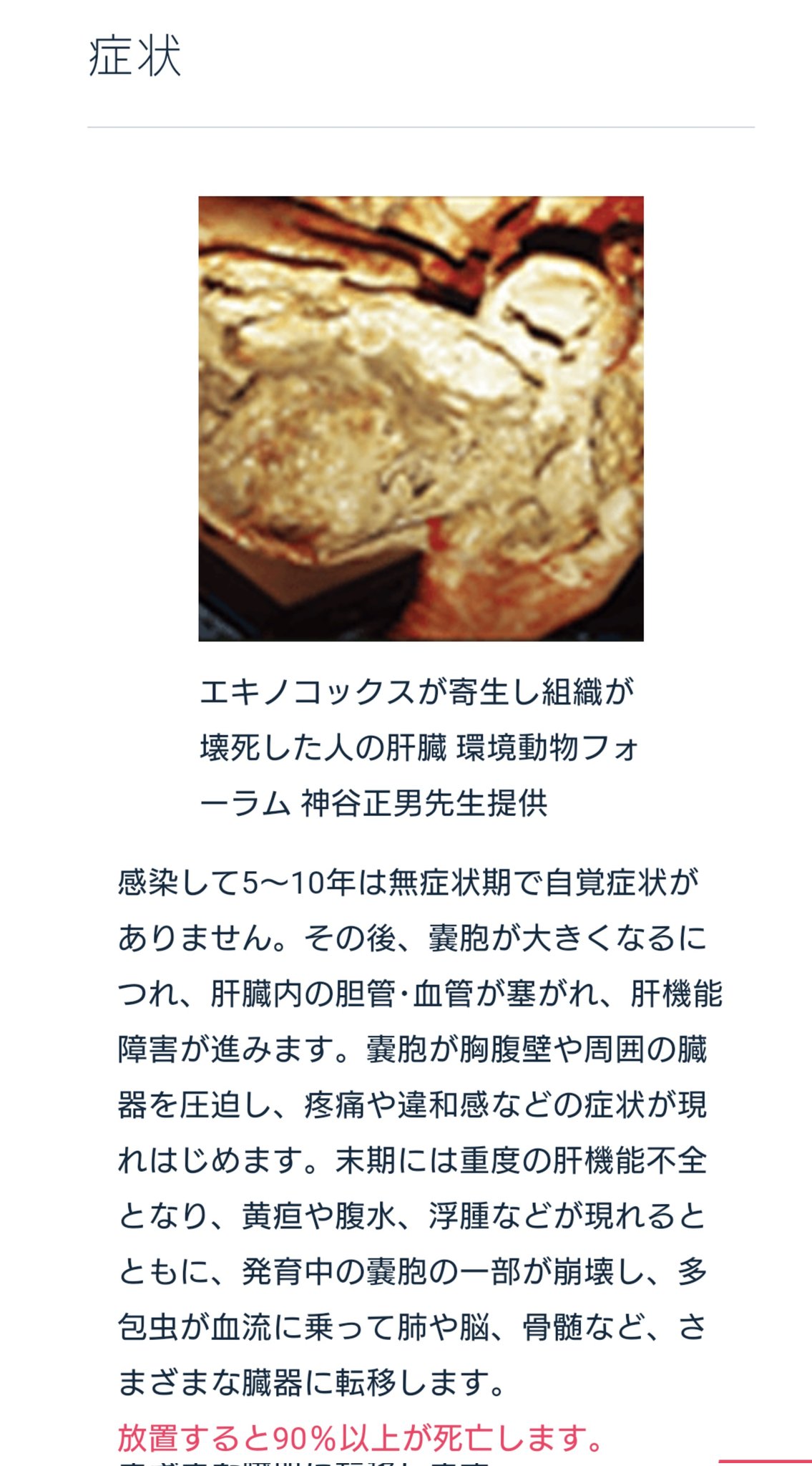エキノコックス症 - Wikiwand
