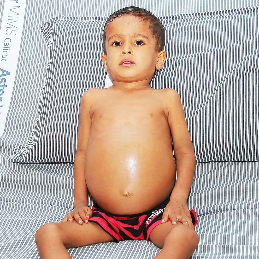 ketto's tweet photo. My 2-yo son is battling cancer. Like a slow poison, it is killing him a little more every day. My husband is a poor coolie. From where can we arrange for lakhs of rupees for our son's treatment? Allah, I can't lose my only child! Please help.

To Support: https://t.co/gEFclqlRQW https://t.co/RzctB2OOpY