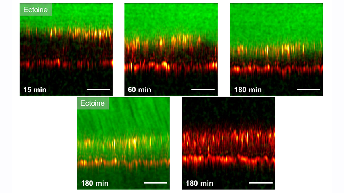 OpticaPubsGroup's tweet image. View Spotlight Analysis of the #OPG_BOEx paper Label-free skin penetration analysis using time-resolved, phase-modulated stimulated Raman scattering microscopy ow.ly/tZcR50Gq5yi Spotlight Summary by Andrey Kuzmin #StimulatedScattering #NonlinearMicroscopy