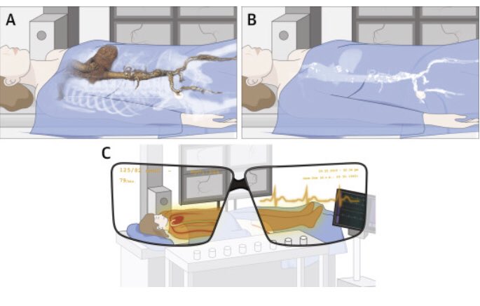Our state-of-the-art paper „Virtual and Augmented Reality in Cardiovascular Care“ is published in #JACCIMG <a href="/JACCJournals/">JACC Journals</a> here is the link: authors.elsevier.com/a/1dvRT,i2XrnB… #cardiotwitter <a href="/TAVRBot/">TAVR Bot</a> <a href="/DLBHATTMD/">Dr. Deepak L. Bhatt</a> <a href="/UniklinikDUS/">Uniklinik Düsseldorf</a> #VirtualReality <a href="/WolffGeorg/">Georg Wolff</a> <a href="/BernhardWernly/">Bernhard Wernly</a>
