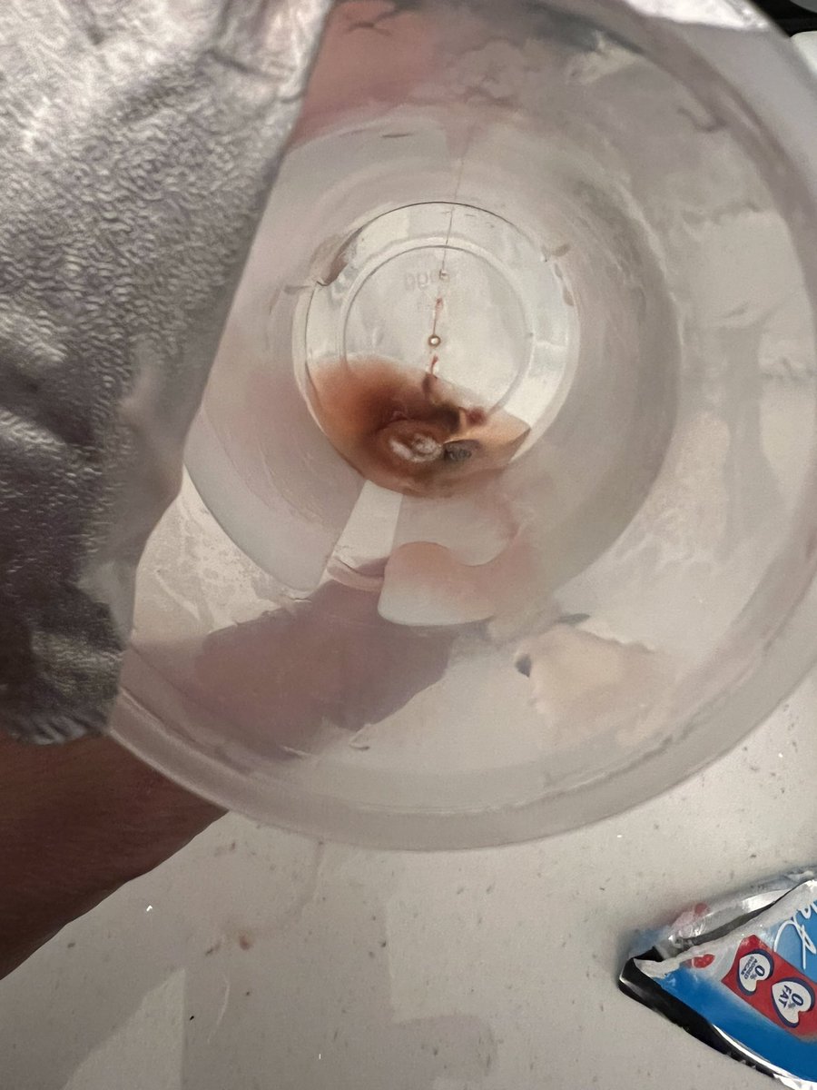 loue11hotmail's tweet photo. @hartleysfruit  this is dated 2022, any ideas? 🤢 https://t.co/U8hj9KCGLD