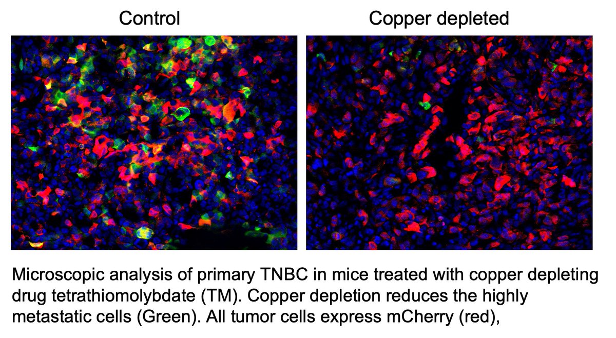 .@mittallab received 2.8 million from NCI to study Copper-Mediated Metabolic Reprogramming And ECM Alterations In TNBC Metastasis. 🌟Congratulations!