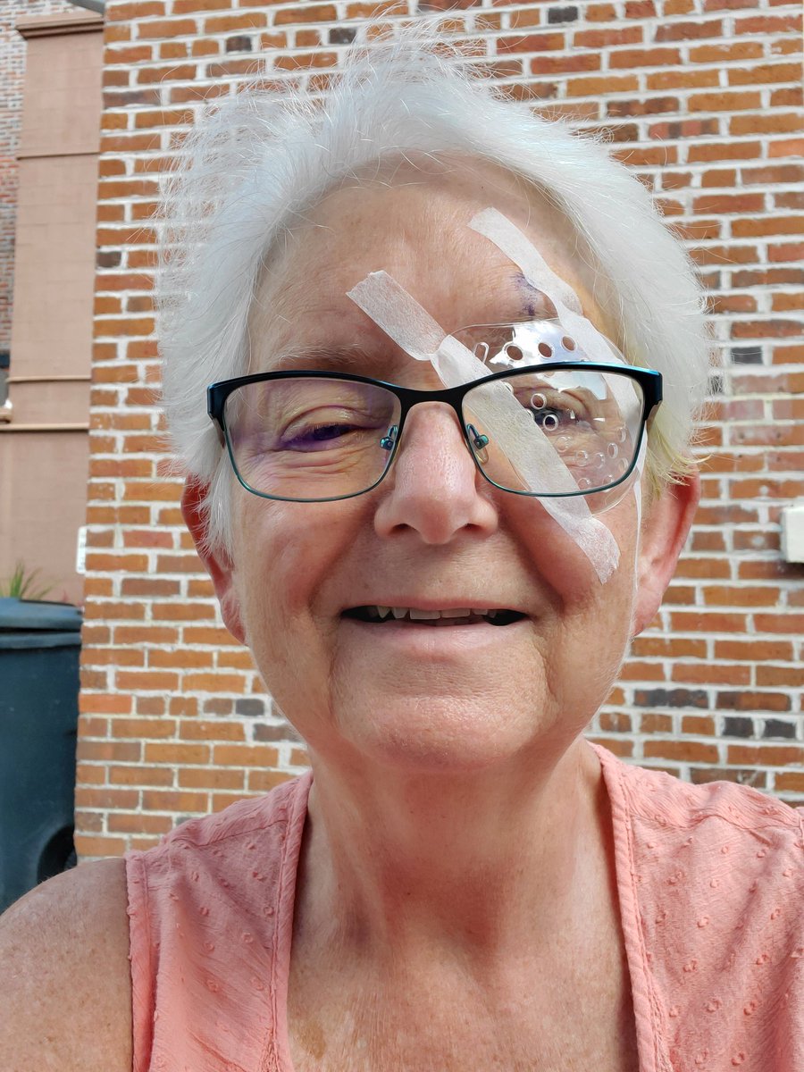 Betsyfru's tweet image. Out to lunch after cataract surgery