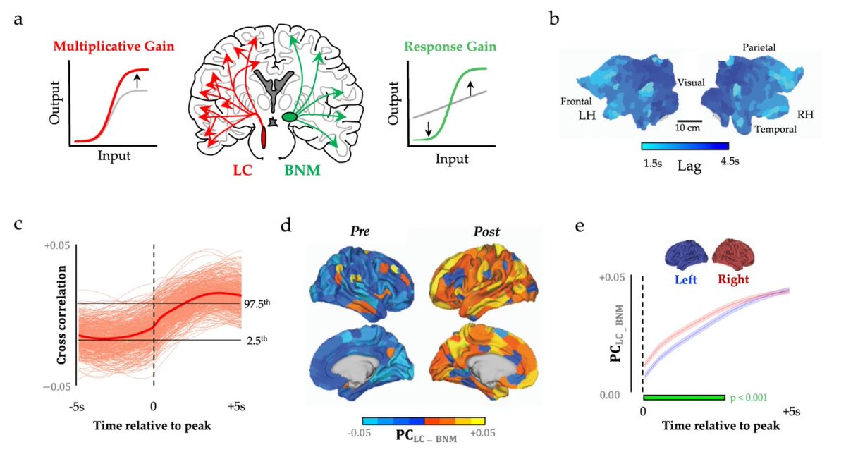 Nature Communications (@naturecomms) on Twitter photo The ascending arousal system mediates low dimensional neural dynamics and internal shifts in conscious awareness
<a href="/DrBMunn/">Brandon Munn</a> <a href="/jmacshine/">Mac Shine</a> @gabwainstein <a href="/eli_j_muller/">Eli Muller</a>
nature.com/articles/s4146… The ascending arousal system mediates low dimensional neural dynamics and internal shifts in conscious awareness
<a href="/DrBMunn/">Brandon Munn</a> <a href="/jmacshine/">Mac Shine</a> @gabwainstein <a href="/eli_j_muller/">Eli Muller</a>
nature.com/articles/s4146…