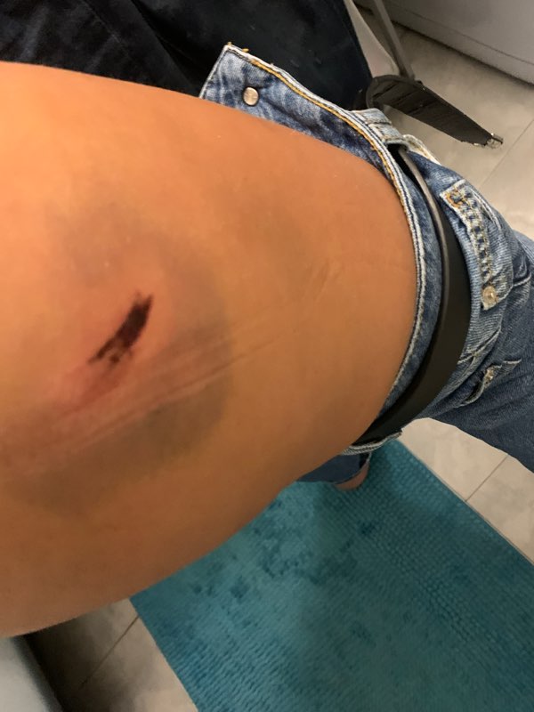 tyasa21's tweet photo. @BalanceTonPost Fin de soirée tranquille avec des amis nous n'avons pas de masques comme tous les gens que nous croisont mais délit de faciès pour un de mes amis et tabassé de sang froid juste pour avoir dit que c'était injuste que je mérite de crever sale pute que je suis...bravo la police https://t.co/n6af0F3hHJ