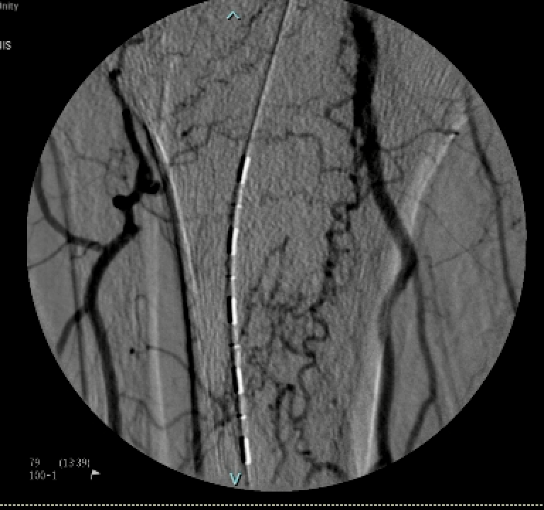 Adam Plotnik MD FSIR tweet media