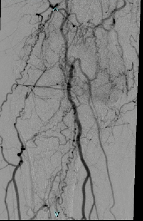 Adam Plotnik MD FSIR tweet media