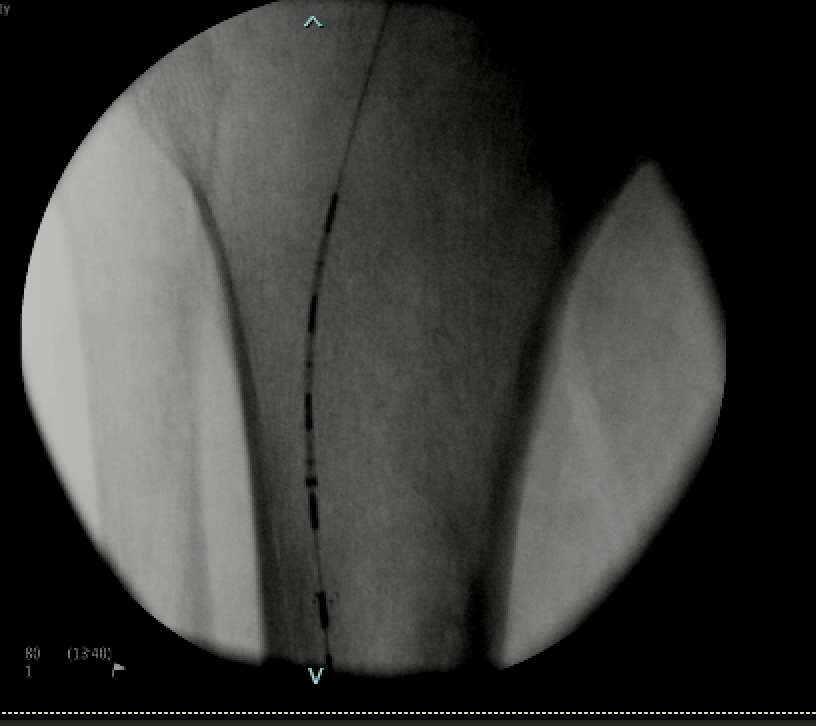 Adam Plotnik MD FSIR tweet media