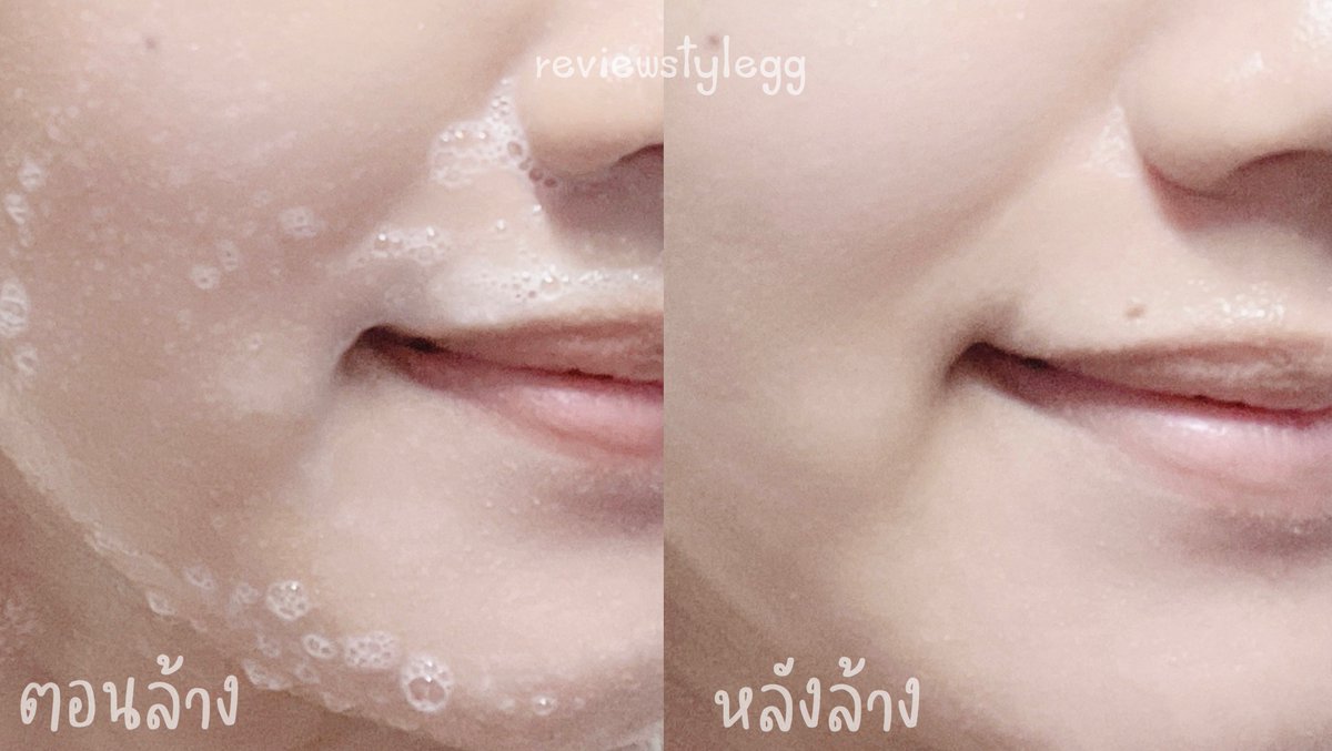 พอรู้ว่าเจลล้างหน้า Mizumi ทำไซส์เล็กมาก็ไม่พลาดที่จะซื้อ 😍 ปกติใช้ไซส์ใหญ่อยู่แล้ว คือชอบเหมาะกับคนเป็นสิวมากกก ลดแบคทีเรียได้ดีย์ ความคุ้มคือใช้ได้ทั้งหน้าและตัว แบบหลอดนี่คือพกพาง่ายแถมหาซื้อได้ตามเซเว่นเลย #GentleAcneWash #ใช้ดีบอกต่อ