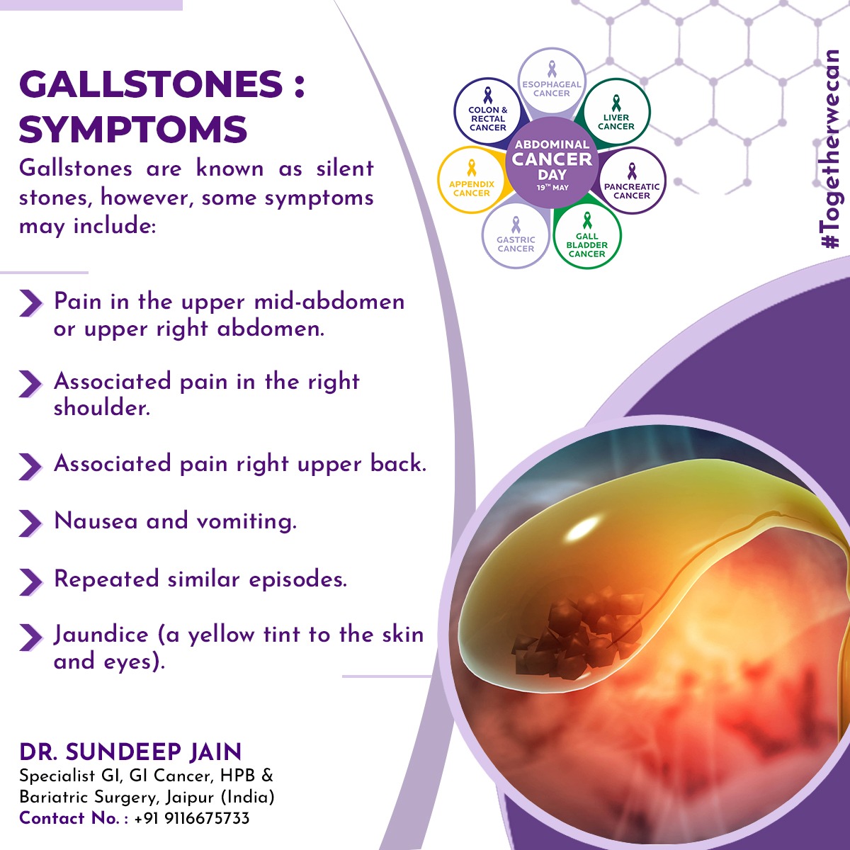 gallbladder stones symptoms