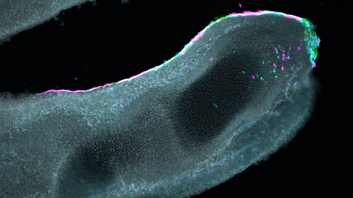This is a developing embryonic digit from a chicken, with fluorescently labelled cells, moving from the digit tip, to the phalanx. Interested? My lab is offering this as a PhD project in 2022! findaphd.com/phds/project/e…