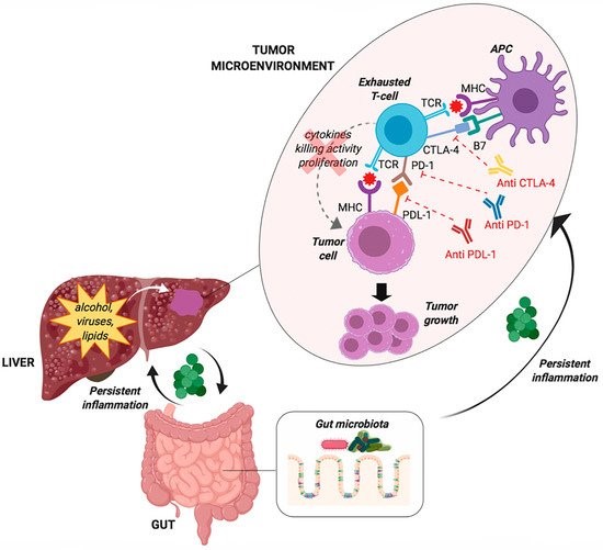 📣Today we share #Review "Overview of Immune Checkpoint Inhibitors Therapy for #Hepatocellular #Carcinoma, and The ITA.LI.CA Cohort Derived Estimate of Amenability Rate to Immune Checkpoint Inhibitors in Clinical Practice"
Find Full-Text on👉mdpi.com/2072-6694/11/1…