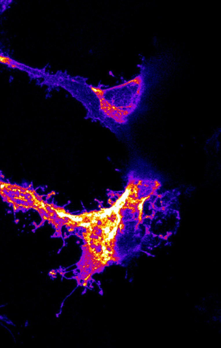KuglerElisabeth's tweet photo. For #FluorescenceFriday we have some beautiful blood vessel cells seeking their path of where to grow in the eye of a developing #zebrafish. 

#endothelialCells #ECs #zebrafish #miscroscopy #migration #evoDevo https://t.co/PofLGkN3Tb