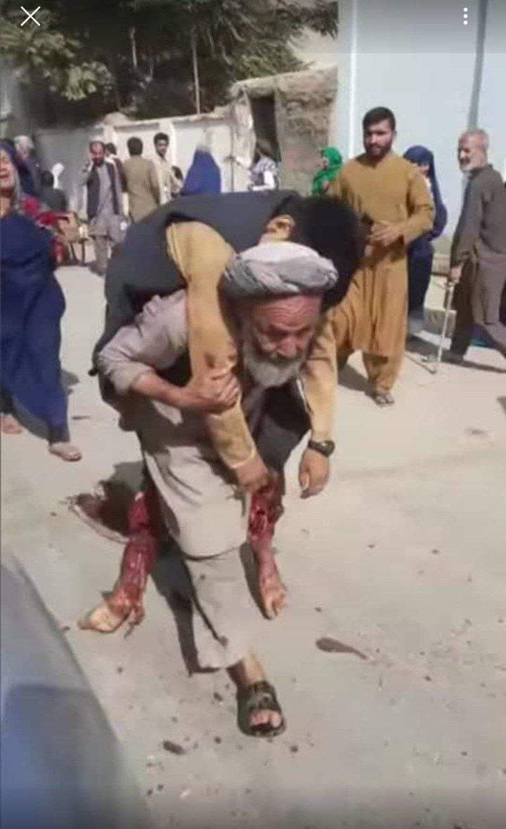 رجل عجوز يحمل ولده الشهيد الذي كان يصلي إلى جانبه في مسجد فاطمة الزهراء في قندهار.
كم هو مؤلم ان يحمل والد جثمان ولده الشاب،
ساعد الله قلبك..