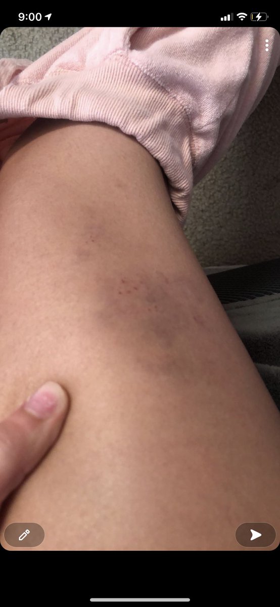 draculasdolll's tweet photo. outing my abuser to protect other women from going through what I did. gannon boatright @crookedassworld on most social media’s. he’s emotionally and physically abusive and will manipulate anyone to sound like the victim. I hope you rot in hell. https://t.co/f1N57DjFju