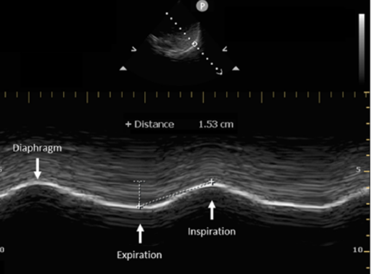UT Southwestern EM Ultrasound tweet media