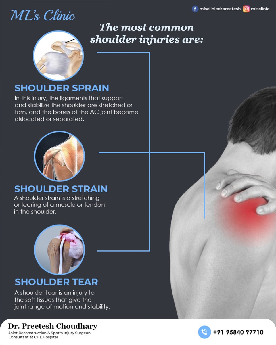 Here are signs that you need to see a doctor:
-Shoulder joint looks deformed
-Can’t use your shoulder at all
-Intense Pain
-Sudden swelling 
-Weak or numb arm or hand 
 Call: 95840 97710
 #MLsClinic #shoulderpain #shoulderworkout  #shouldersprain  #shouldertear