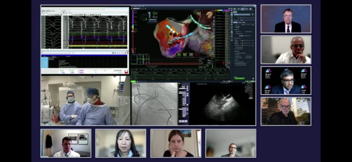 Andrew Campadonico (@arcampado) on Twitter photo Great LIVE Case presentation with <a href="/Dr_Santangeli/">Pasquale Santangeli</a> at #VTS2021. Multiple morphology VT substrate mapped with #HDGrid. <a href="/maddyferraro1/">maddyferraro</a> <a href="/MikeRaiman/">Mike Raiman</a> <a href="/PennCardiology/">Penn Cardiology</a> <a href="/AbbottCardio/">Abbott Cardiovascular</a> Great LIVE Case presentation with <a href="/Dr_Santangeli/">Pasquale Santangeli</a> at #VTS2021. Multiple morphology VT substrate mapped with #HDGrid. <a href="/maddyferraro1/">maddyferraro</a> <a href="/MikeRaiman/">Mike Raiman</a> <a href="/PennCardiology/">Penn Cardiology</a> <a href="/AbbottCardio/">Abbott Cardiovascular</a>