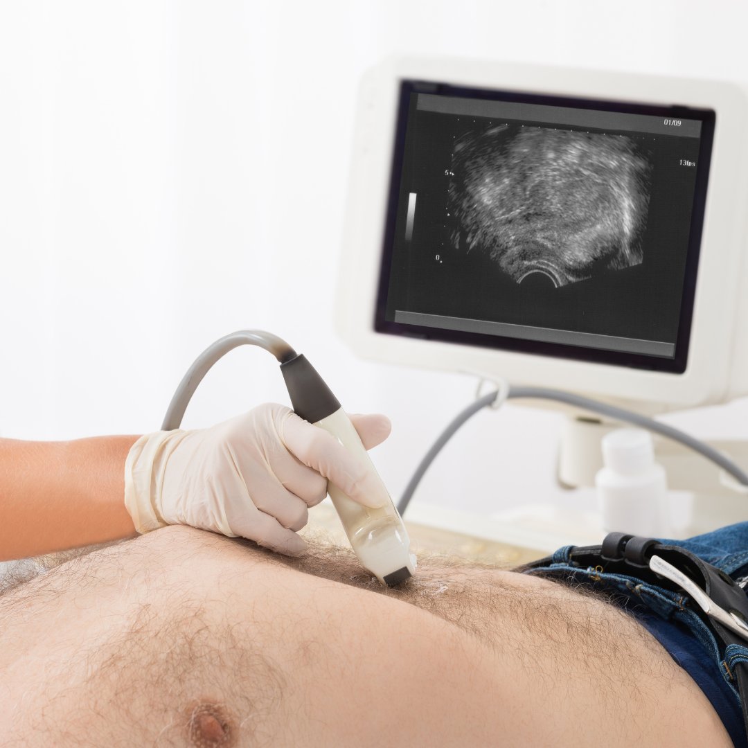 Everything You Need to Know About Abdomen Ultrasounds 

Read more: 1l.ink/FHJL37C

#TheUltrasoundCentre #Warman #Saskatoon #Rosthern #MedicalDiagnosticImagingCentre #MedicalImagingCentre #MedicalCentre #MedicalOffice #Ultrasound #LocalRadiologists