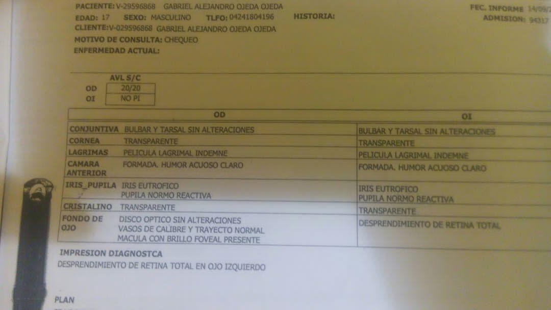 dar39ling's tweet photo. Tenemos en #Catia un adolescente 17 años con desprendimiento de retina..me ayudan a encontrar un oftalmólogo que lo ayude...@MamaLisVzla @AlexaGomezDos @fundatiacruz mi gente ayudenme con un Rt hasta encontrar ese Ángel #Gracias https://t.co/yBC8kqoN0j