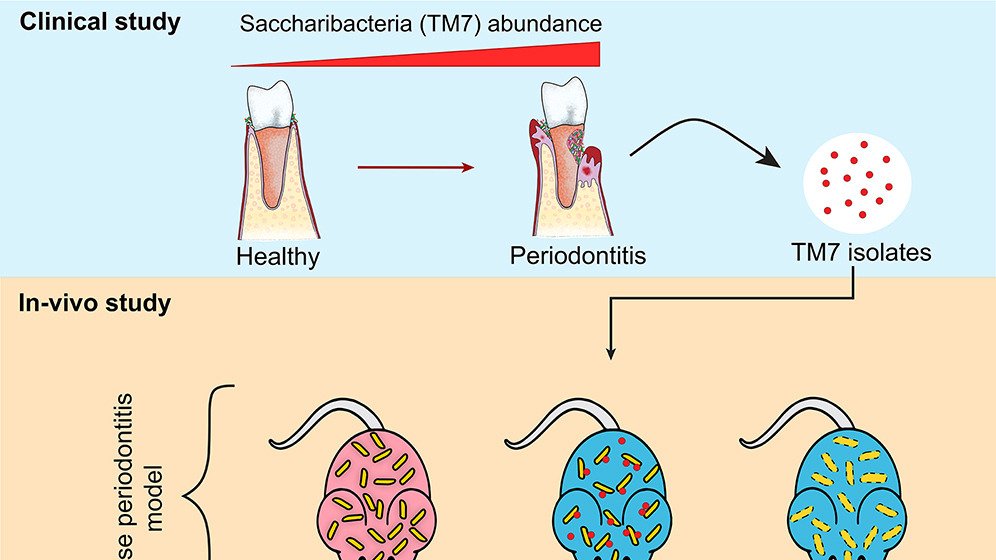 Cell Host & Microbe (@cellhostmicrobe) on Twitter photo Epibiont suppresses gingival inflammation: Using a mouse model for #periodontitis, <a href="/BatbilegBor/">Batbileg Bor</a> <a href="/bajenak/">Daniel Utter</a> & Chipashvili determine that episymbiotic Saccharibacteria suppresses #gingival inflammation and bone loss by modulating host #bacterial pathogenicity cell.com/cell-host-micr… Epibiont suppresses gingival inflammation: Using a mouse model for #periodontitis, <a href="/BatbilegBor/">Batbileg Bor</a> <a href="/bajenak/">Daniel Utter</a> & Chipashvili determine that episymbiotic Saccharibacteria suppresses #gingival inflammation and bone loss by modulating host #bacterial pathogenicity cell.com/cell-host-micr…