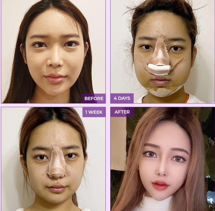 Top Tweets For 頬骨 Twstalker