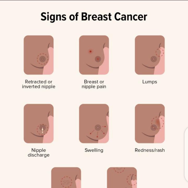 CANDICESWAN's tweet photo. Get yourself checked, now! #NoBraDay https://t.co/GonUPUAzB6