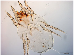 Foto de ácaro al microscopio en colores marrones translúcidos. Parece un escarabjo muy gordo.