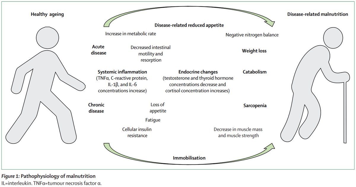 New Review: Management of disease-related #malnutrition for patients being treated in hospital, from <a href="/SchuetzphS/">Philipp Schuetz</a> and colleagues. hubs.ly/H0Zwy230