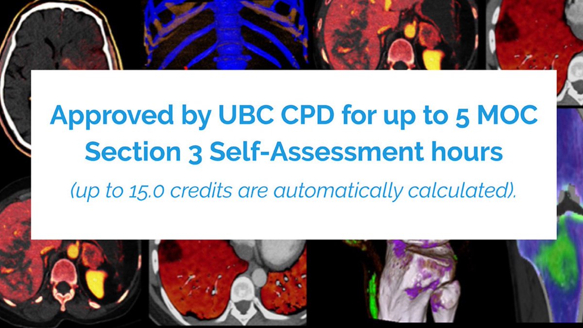 BCRadSoc's tweet photo. Live, Online, Virtual CME. 

Introducing Dual Energy CT to Your Practice: Tips and Practical Applications – Virtual CME

November 6, 2021
8:00 am - 12:30 pm PST

Register: https://t.co/bkdXaRDVkY https://t.co/0wUAvjZufO