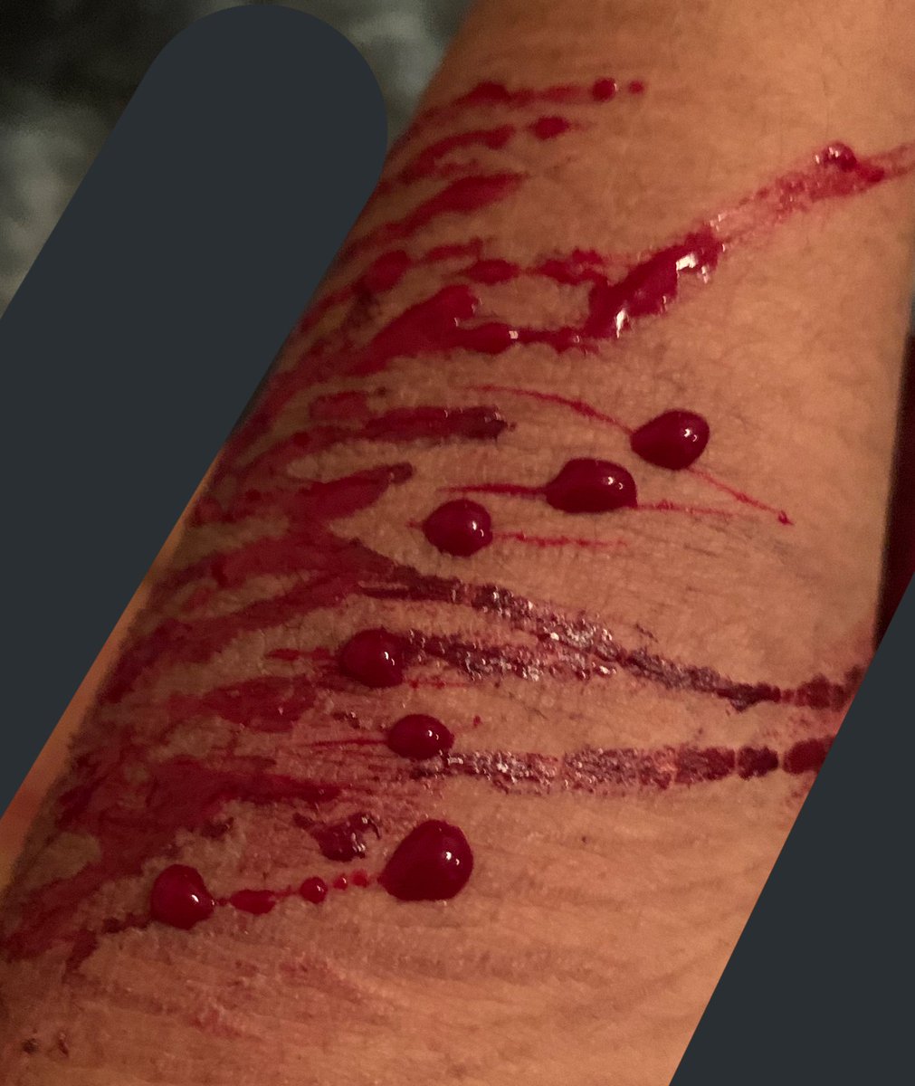 doodooheadass71's tweet photo. tw-cw//blood,sh
-
-
-
-
-
-
-
-
-
-
-
-
-
-
-
cuts buds shtwt barcodetwt yeettwt https://t.co/7nU7rh20FA