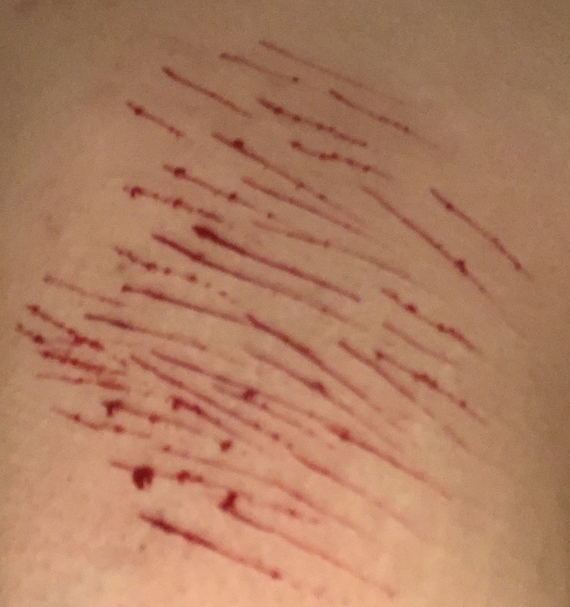 doodooheadass71's tweet photo. tw-cw//blood,sh
-
-
-
-
-
-
-
-
-
-
-
-
-
-
-
cuts buds shtwt barcodetwt yeettwt https://t.co/7nU7rh20FA