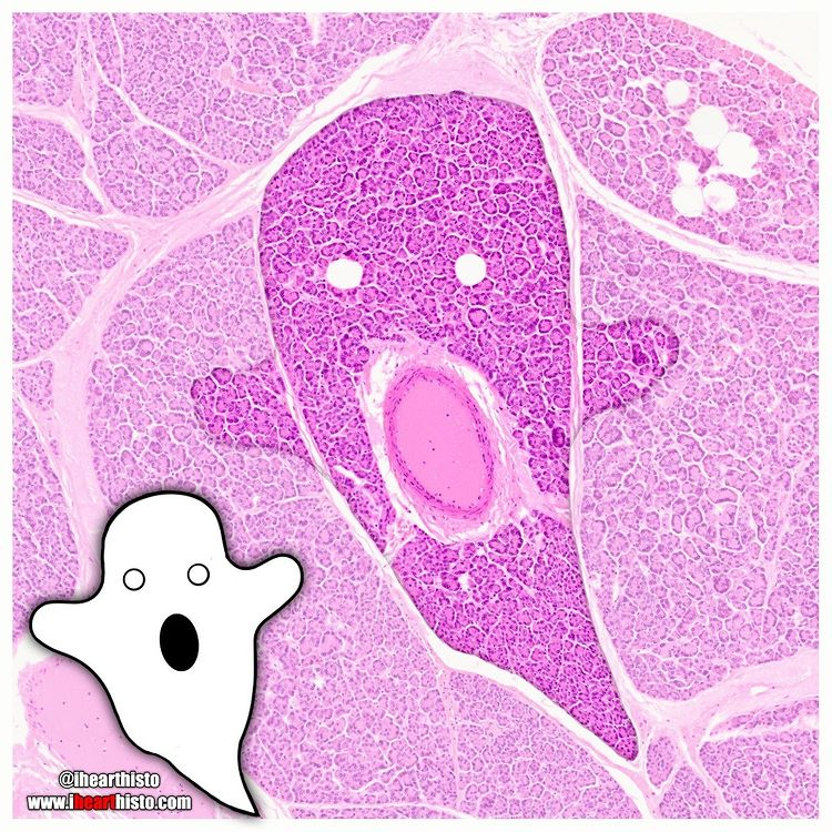 IHeartHisto's tweet photo. 👻 PancreAAARGGHHHs 👻

A serous specter in a gland so terrifying it will leave you exocryin' AND endocryin' into your pumpkin spice latte

#histology #anatomy #pathology #pathologists #halloween https://t.co/whdeJoMApC