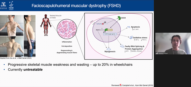 UniMelbCMR's tweet photo. CMR Masters student, Matteo Pitteri, presenting at the VMN symposium on β2-Adrenergic receptor signalling as a potential therapy for FSHD.
@VicMuscleNet https://t.co/cQQ5tSELEp