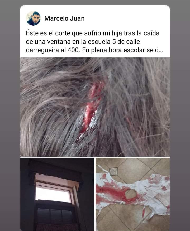 Yanelit09's tweet photo. A mí hija hoy, estando en la escuela, SE LE CAYO UNA VENTANA EN LA CABEZA. En un lugar donde dejamos a nuestros hijos tranquilos porque están seguros. 
https://t.co/dPqZMstiJH

@lajeantonio @JonatanViale @edufeiok @LanataPPT https://t.co/De4PEqOL48
