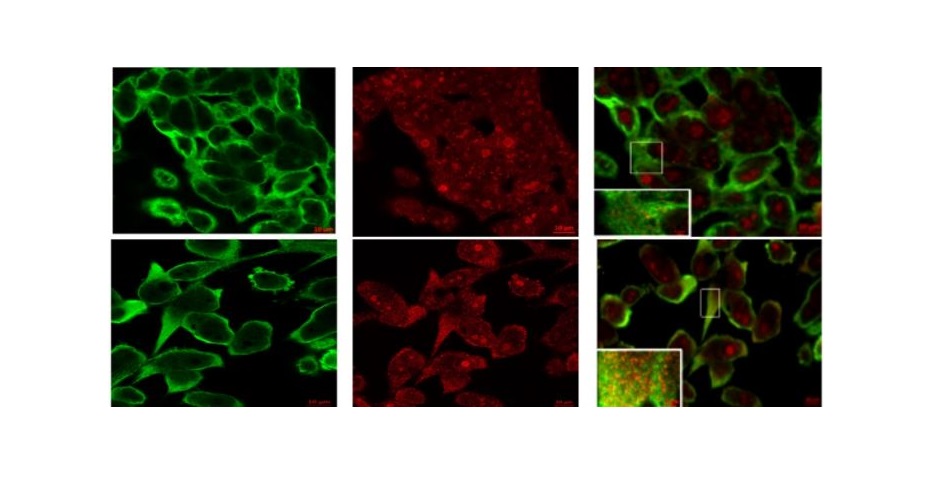 Prostate Cell News (@prostatecell) on Twitter photo Dr. Palma Rocchi (<a href="/palmarocchi1/">palma rocchi</a>) and colleagues at Aix-Marseille University in France revealed differential DNA binding sites of menin in various #prostatic cells, suggesting a switch 🔀 from tumor suppressor to oncogenic function.
#OpenAccess here! 👀🔬
go.nature.com/3EsDes6 Dr. Palma Rocchi (<a href="/palmarocchi1/">palma rocchi</a>) and colleagues at Aix-Marseille University in France revealed differential DNA binding sites of menin in various #prostatic cells, suggesting a switch 🔀 from tumor suppressor to oncogenic function.
#OpenAccess here! 👀🔬
go.nature.com/3EsDes6