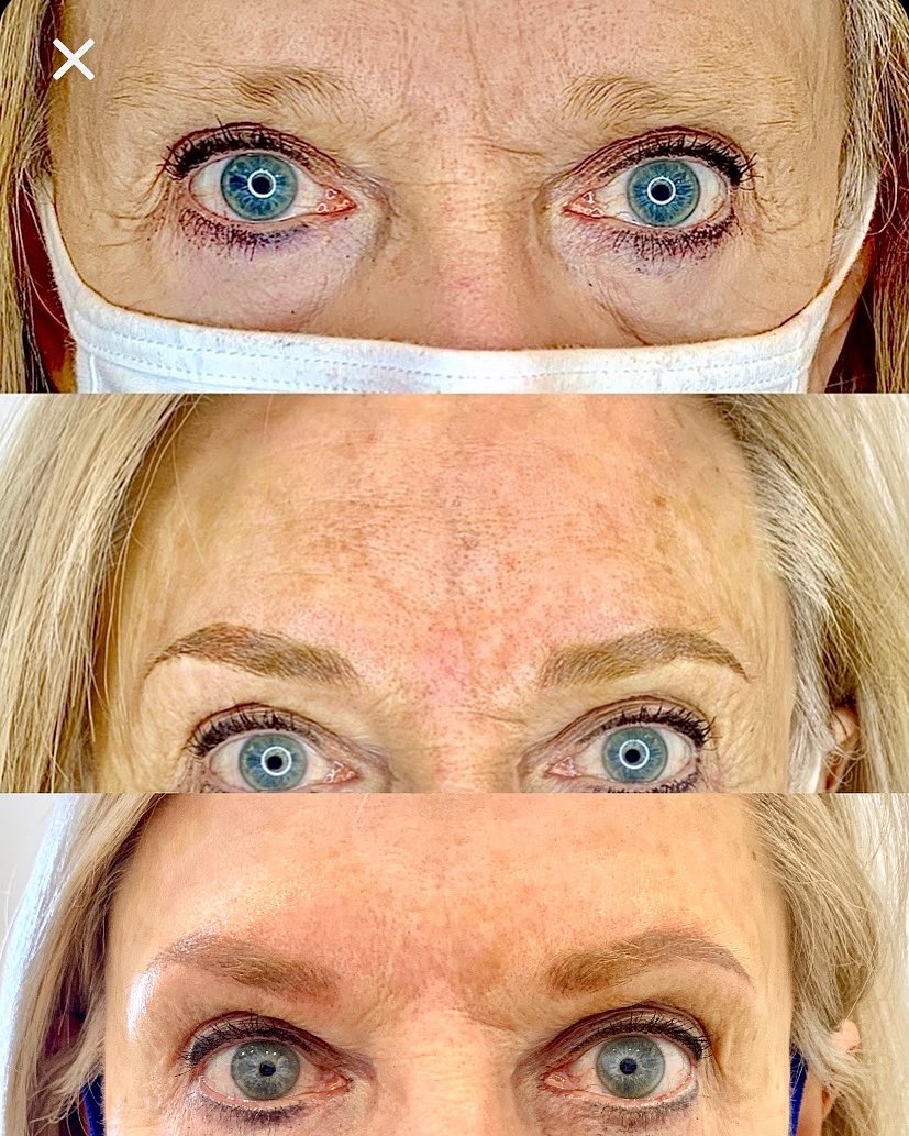 Before, After & Healed #combobrows #microblading #powderbrows
