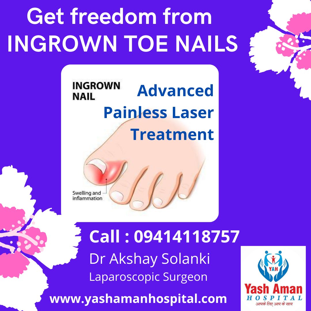 Are you suffering from INGROWN TOENAILS ? It is Painfull. Get rid from it with Advanced LASER SURGERY at very affordable cost Done by highly experienced surgeon Dr AKSHAY SOLANKI. NO CUTS & NO STITCHES.
Call : 09414118757 
yashamanhospital.com/index.php/ingr…
#painlesstreatment #lasersurgery