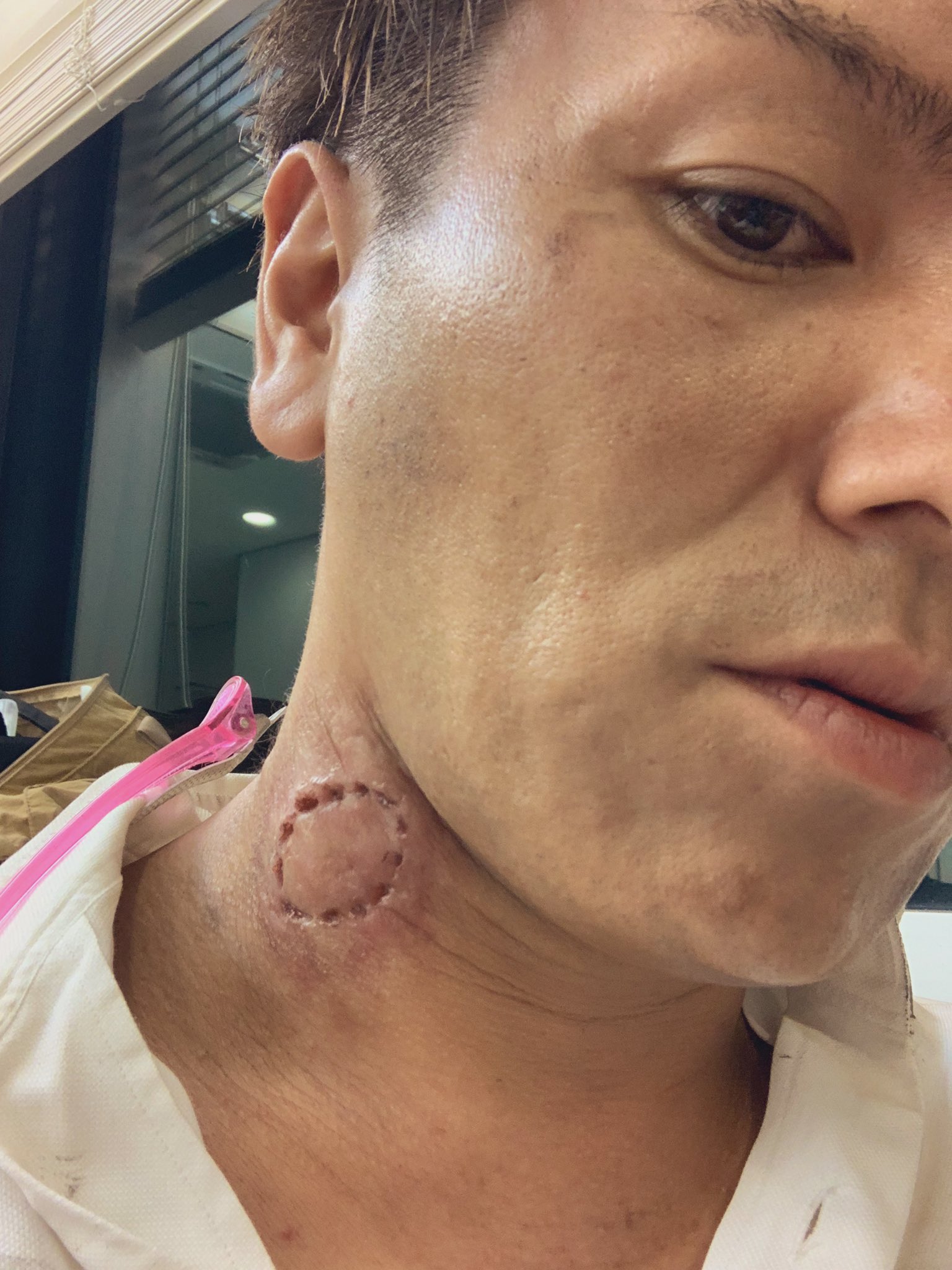 狩野英孝 噛まれちまった アディオス ウォーキングデッドサバイバー T Co 5zt7qepy5v Twitter